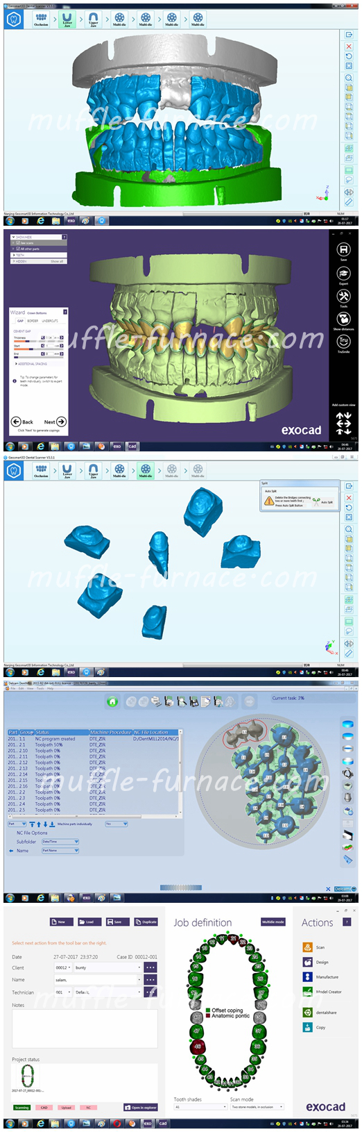 Blue Light 3D Scanner Dental Lab Furnace , Dental Lab Equipment For Teeth 2